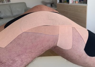 Ukázka správně provedeného tejpování kolene
