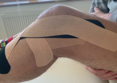Ukázka tejpování kolene ze bočního pohledu